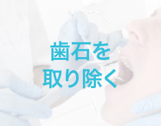 歯石を取り除く
